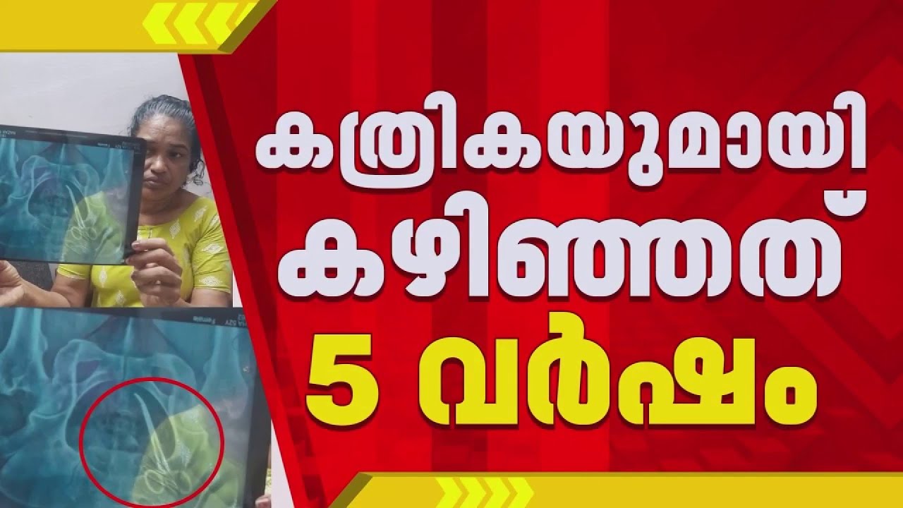 'സർജറി നടത്തിയത് 5 വർഷം മുമ്പ് ലളിതാംബിക ഡോക്ടര്‍,തിങ്കളാഴ്ച പുറത്തെടുക്കാമെന്ന് ആശുപത്രി'