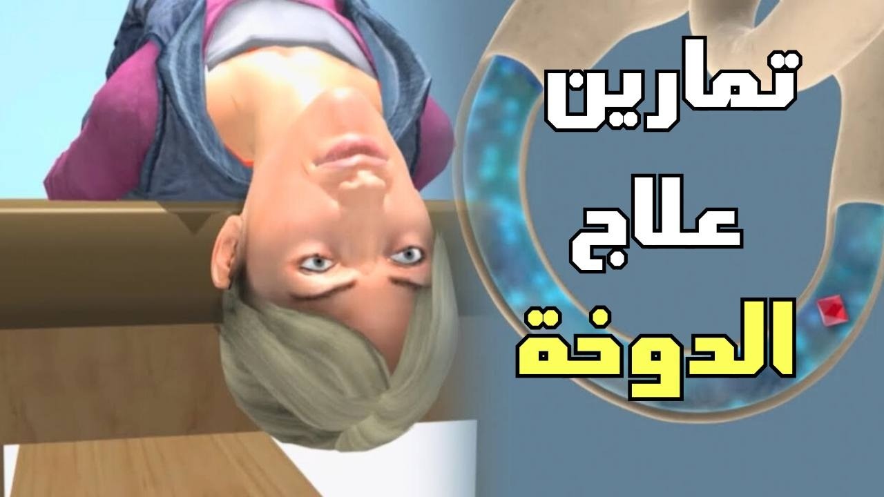 شاهد وتعلم تمارين علاج الدوخة في المنزل  _ Epley Maneuver to Treat BPPV Vertigo