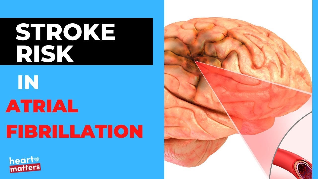 Atrial Fibrillation (AF) and the Risk of Stroke
