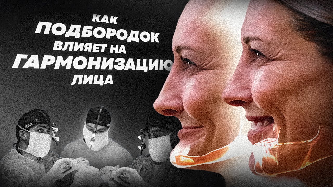Гениопластика или Ментопластика🤔| Разбор операции и какие преимущества  у гениопластики