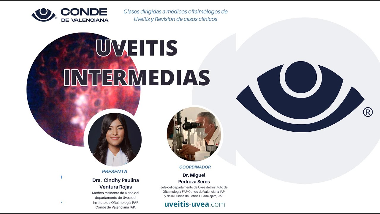 Uveitis intermedias. Pars Planitis