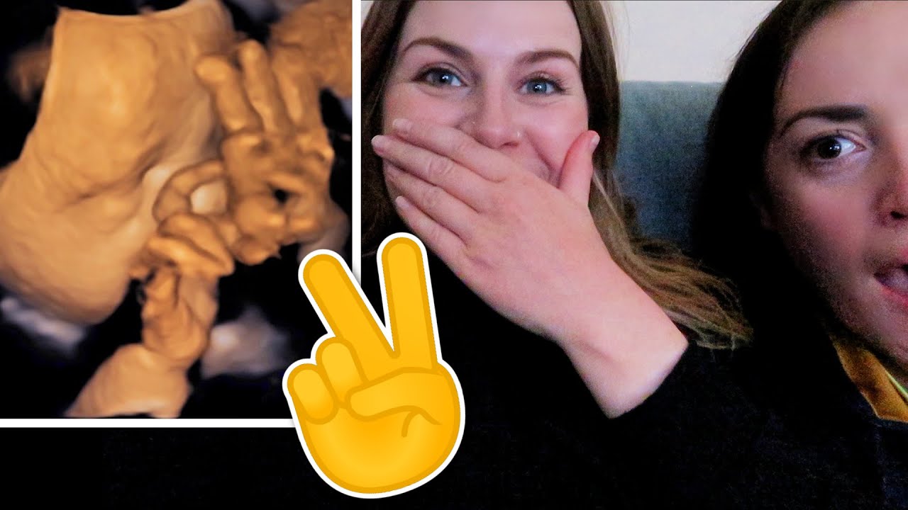 Seeing our baby's face for the first time!