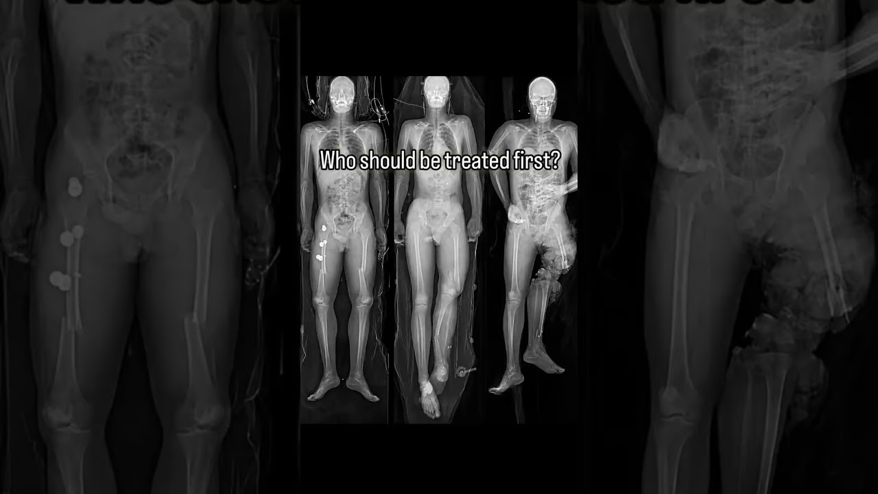 Can You Make the Right Call in This ER Triage Case???