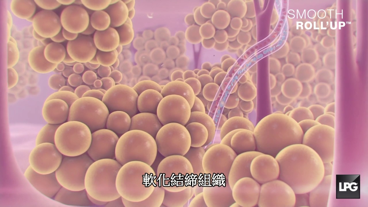 水四季-LPG第九代纖體雕塑療程