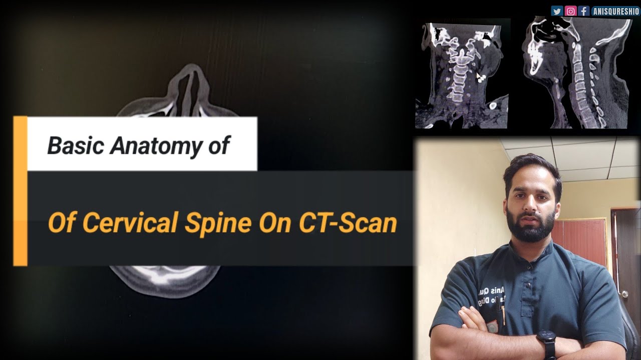 Basic Anatomy of Cervical Spine on CT SCAN| By Anis Qureshi
