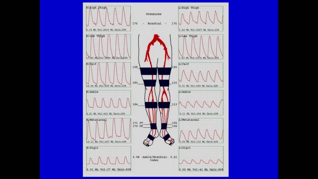 2016 AOCR Radiology Case Review: Ultrasound - Peripheral Vascular Disease