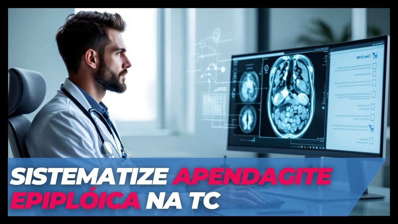 Como n&atilde;o deixar passar um diagn&oacute;stico de apendagite epipl&oacute;ica na TC de abdome
