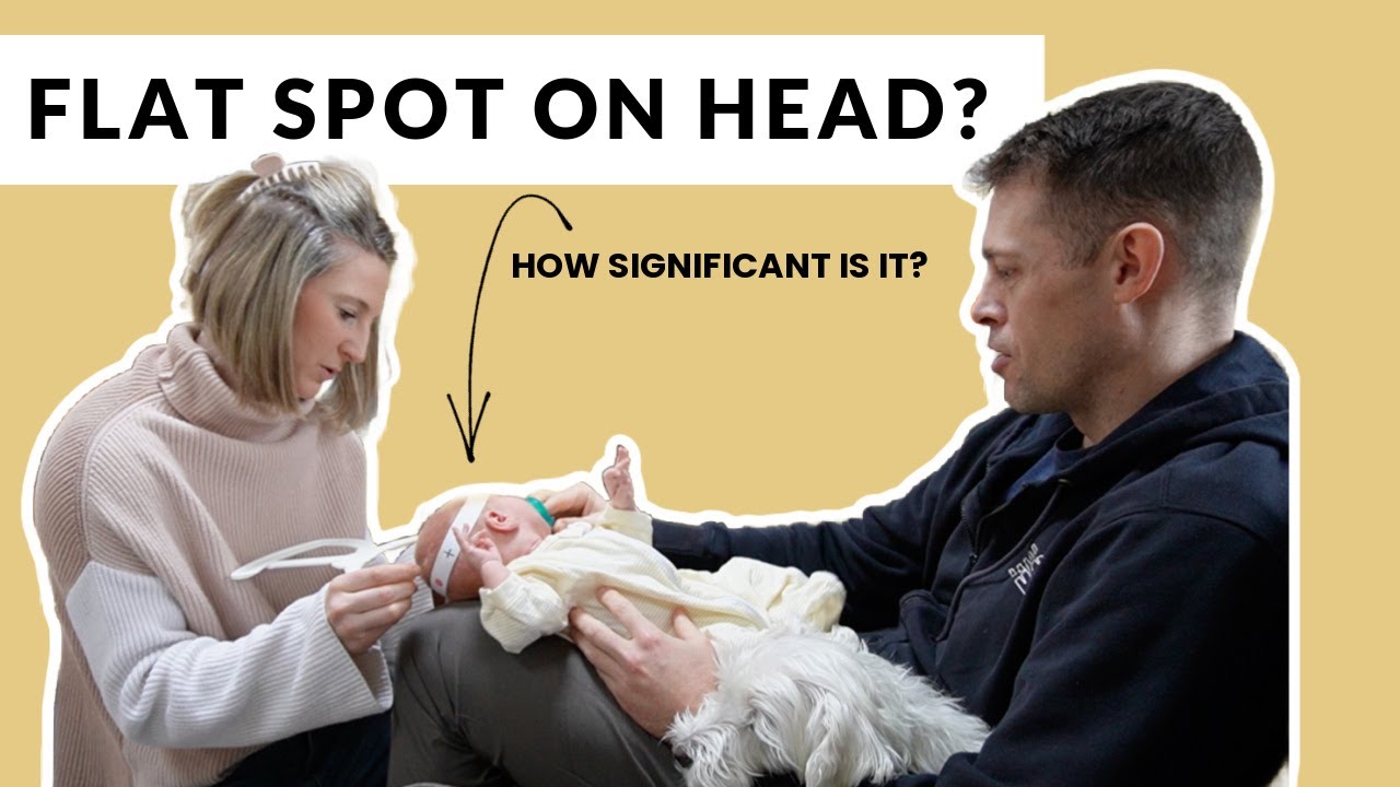 Baby Head Shapes: What To Do If You See A Flat Spot On Your Baby's Head