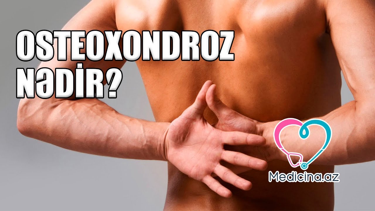 Osteoxondroz nədir?