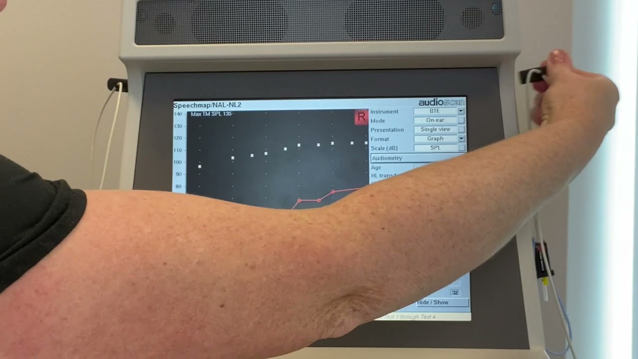 What is Real Ear Measurement?