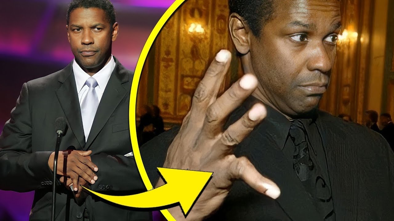 15 Famous People With Physical Deformities You Never Noticed