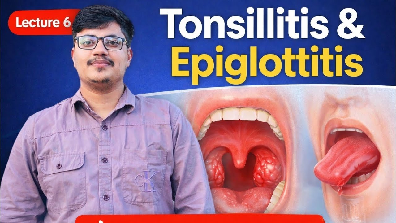 Tonsillitis and Epiglottitis in One Shot | Causes, Symptoms, Treatment#Tonsillitis#Epiglottitis#ENT