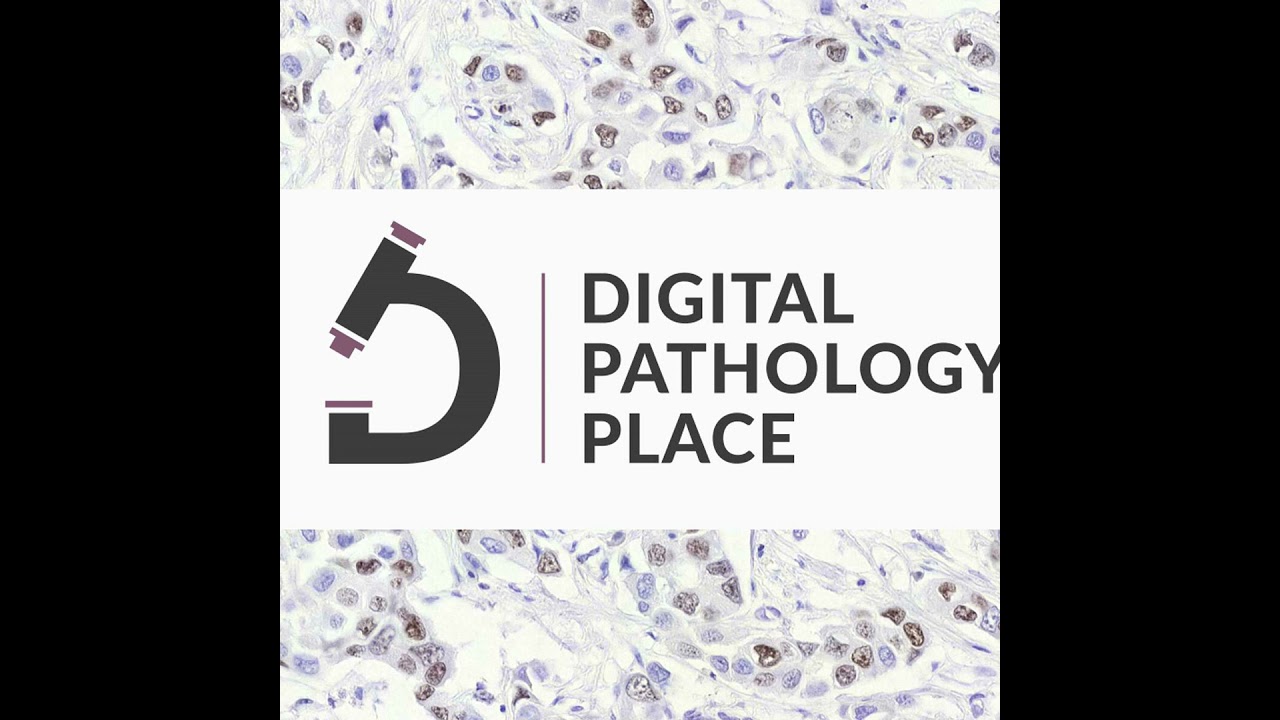 190: Can a Better Stain Improve AI in Pathology?