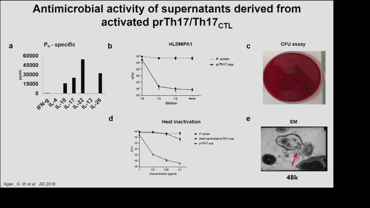 Antimicrobial Activity of Cytolytic Th17 Cells Targeting Propionibacterium Acnes