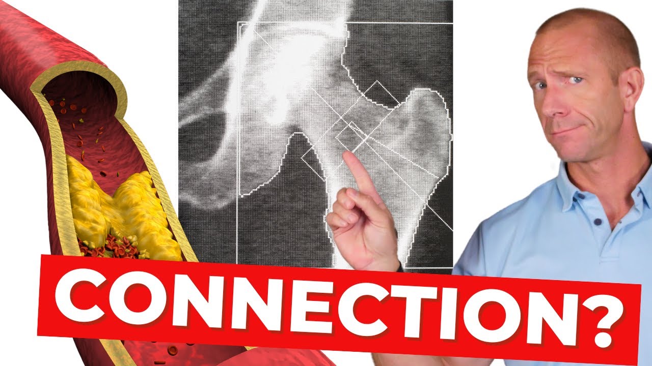 Is Vitamin K the KEY to Bone Health?
