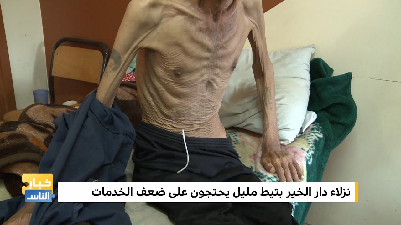 روبورتاج .. نزلاء 
