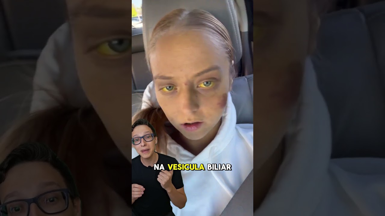 Icterícia 😱