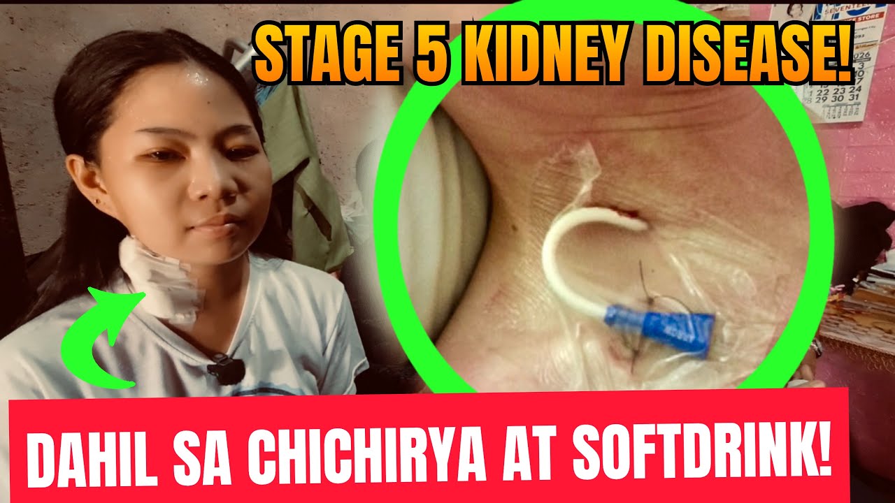 OMG! ALLIONA 26 YEARS OLD NAG DA DIALYSIS‼️