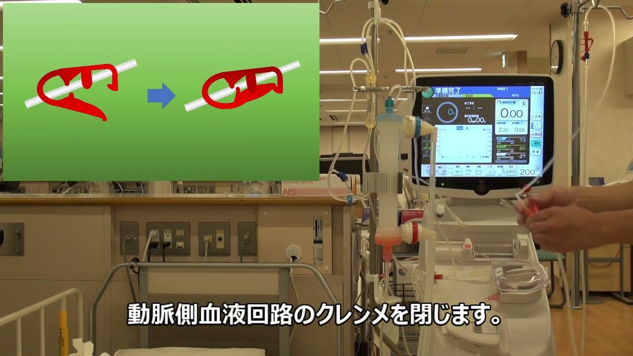 ３．脱血方法～体重測定、データ転送、脱血方法、開始時間入力血圧入力まで～