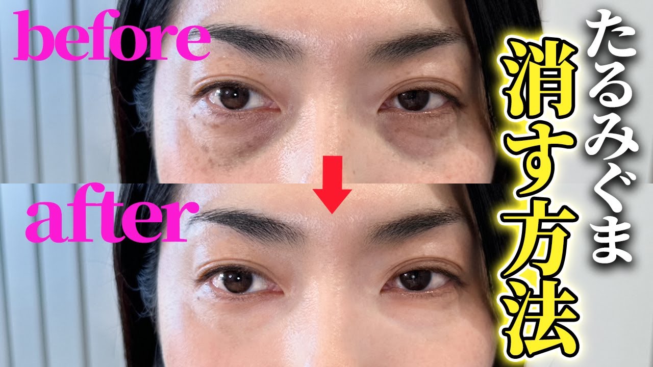 【40代50代】シワにたまらない！たるみくまが綺麗にカバー出来る方法