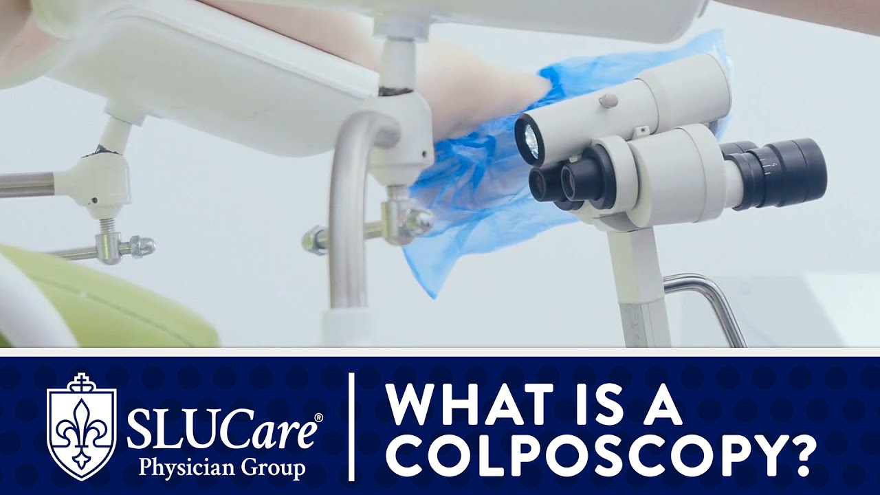 What is a Colposcopy and What is It For?  - SLUCare OB/GYN