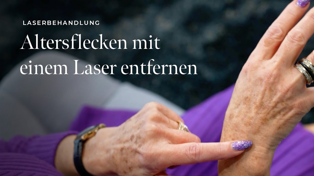 Altersflecken mit einem Laser entfernen | skinmed - Dermatologie in Lenzburg, Aargau