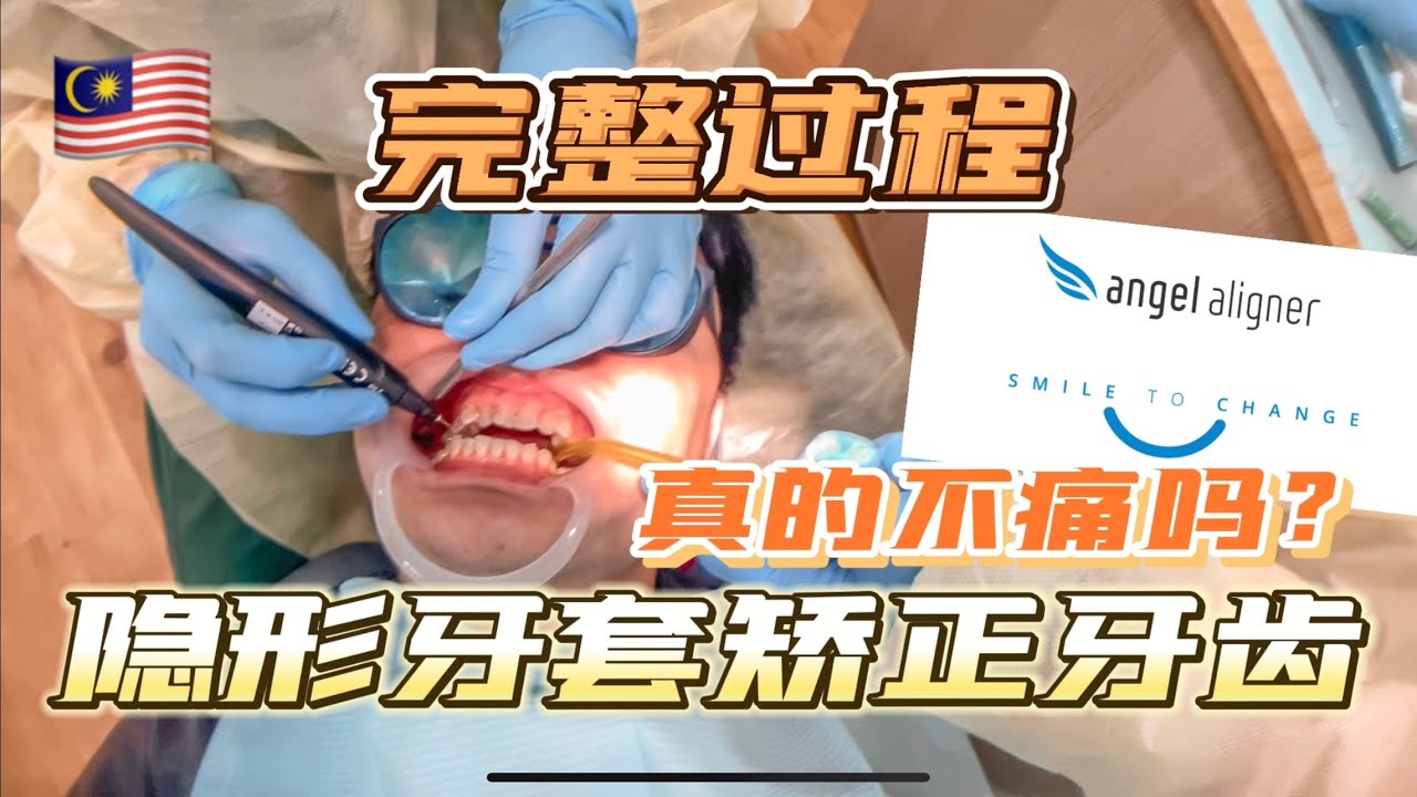 隐形牙套好舒服 最新绑牙技术 矫正牙齿不再那么痛苦啦 #马来西亚绑牙 #Angelalign