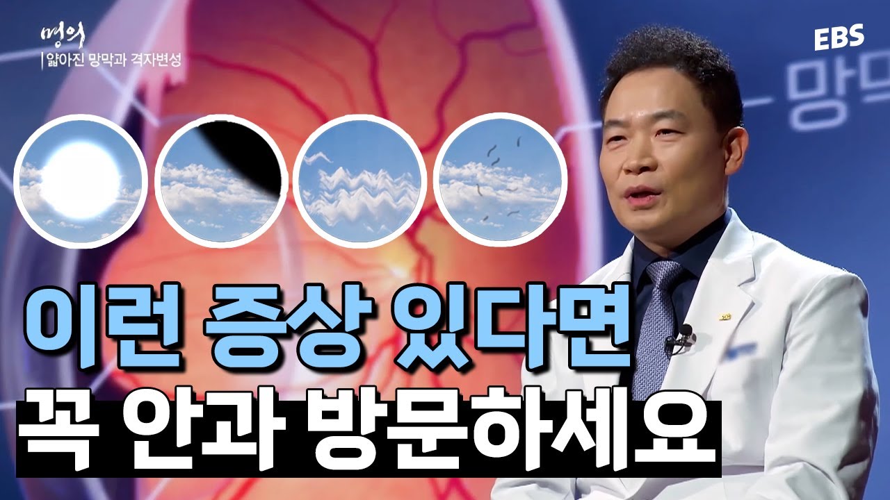 [#명의] 방치하면 실명에 이르게 된다고? 꼭 안과에 방문해야 하는 증상 | 명의 - 실명할 수 있습니다 - 망막박리