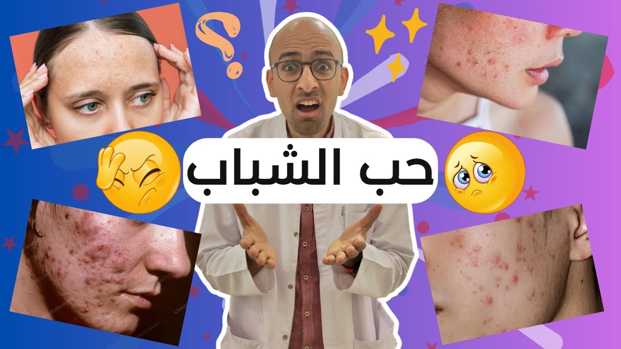 حب الشباب - الاسباب و العلاج - سبب حب الشباب