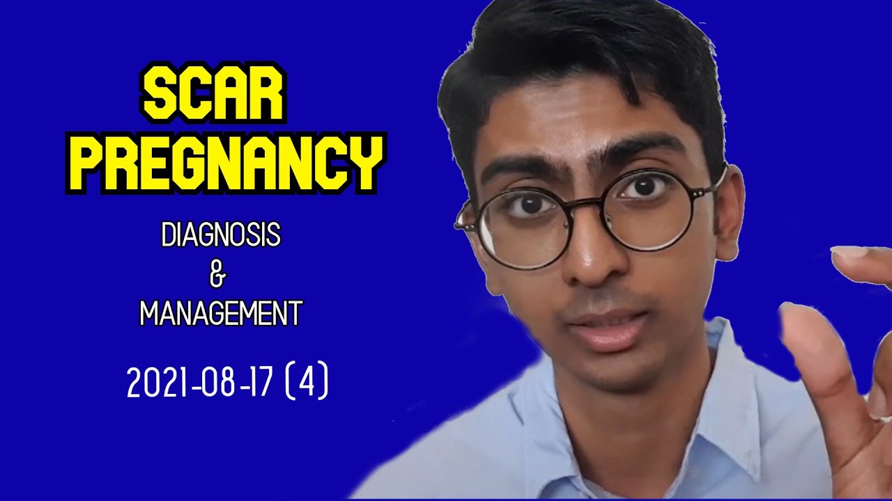 Caserean Scar Pregnancy and Ectopic Scar Pregnancy | Antai Hospital