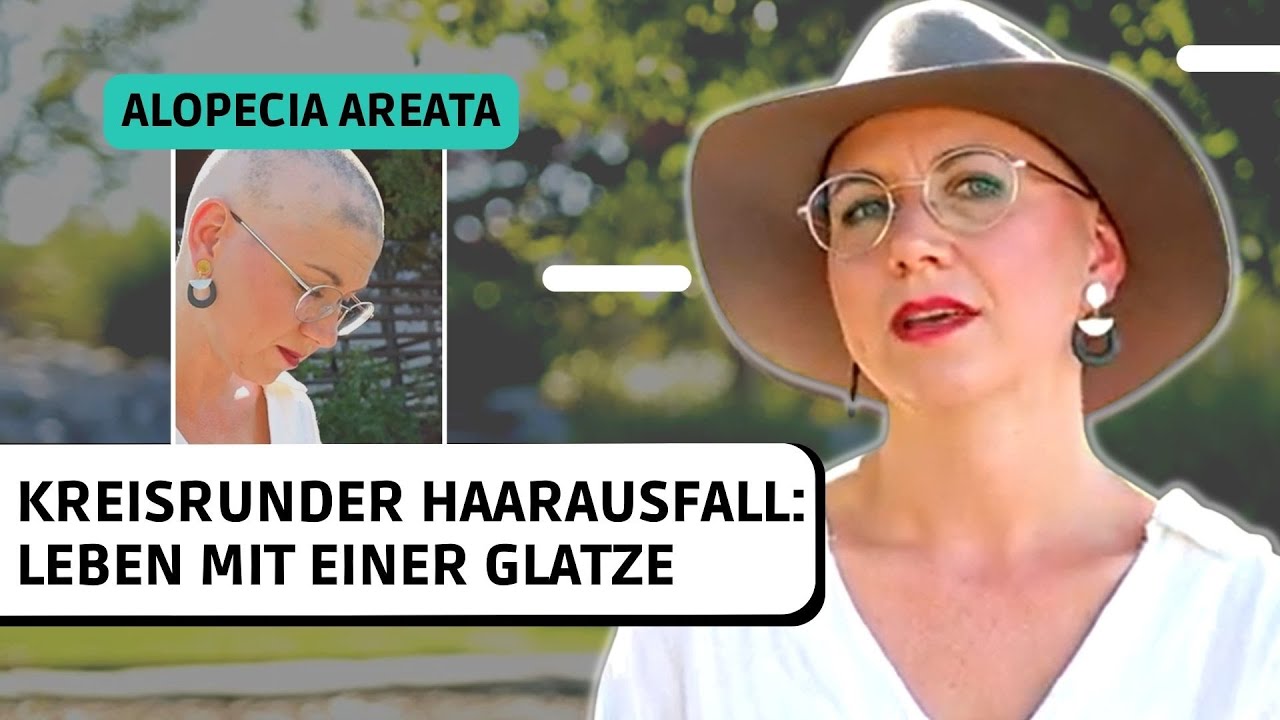 Kreisrunder Haarausfall: Wenn junge Frauen mit einer Glatze leben müssen | Über Scham und Selbstwert