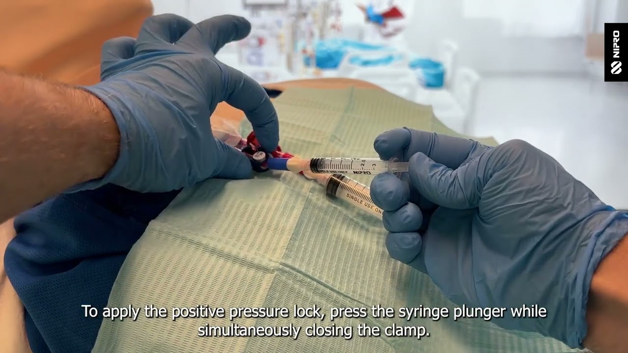 iMEP Tips & Tricks 25: Positive pressure locking