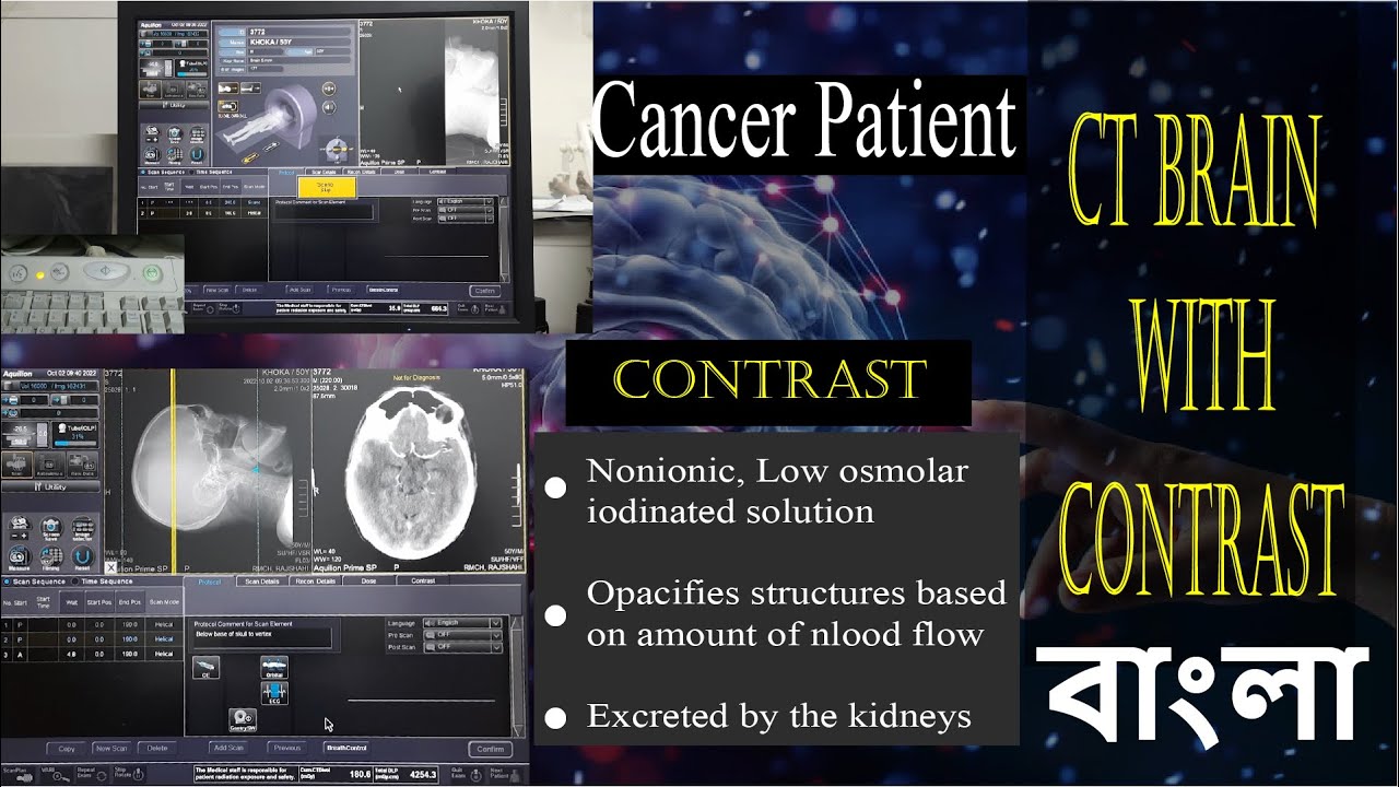 How to do CT Scan of Brain with Contrast