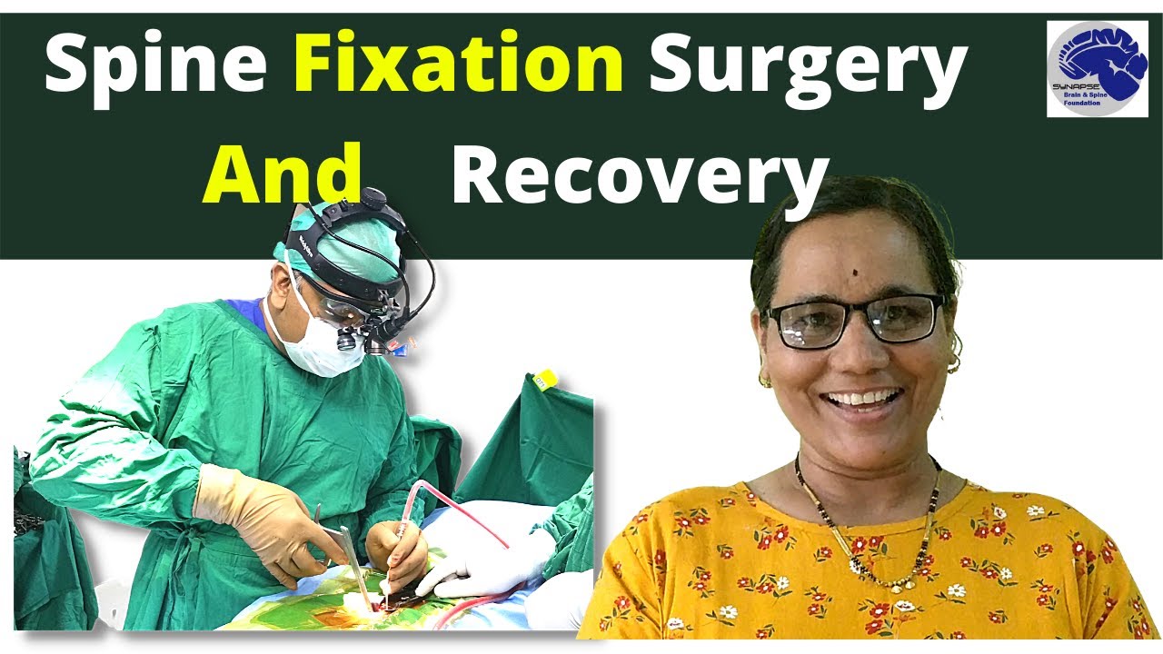 Spine fixation and recovery. Dr Jaydev Panchwagh. Spine specialist in Pune. 2021