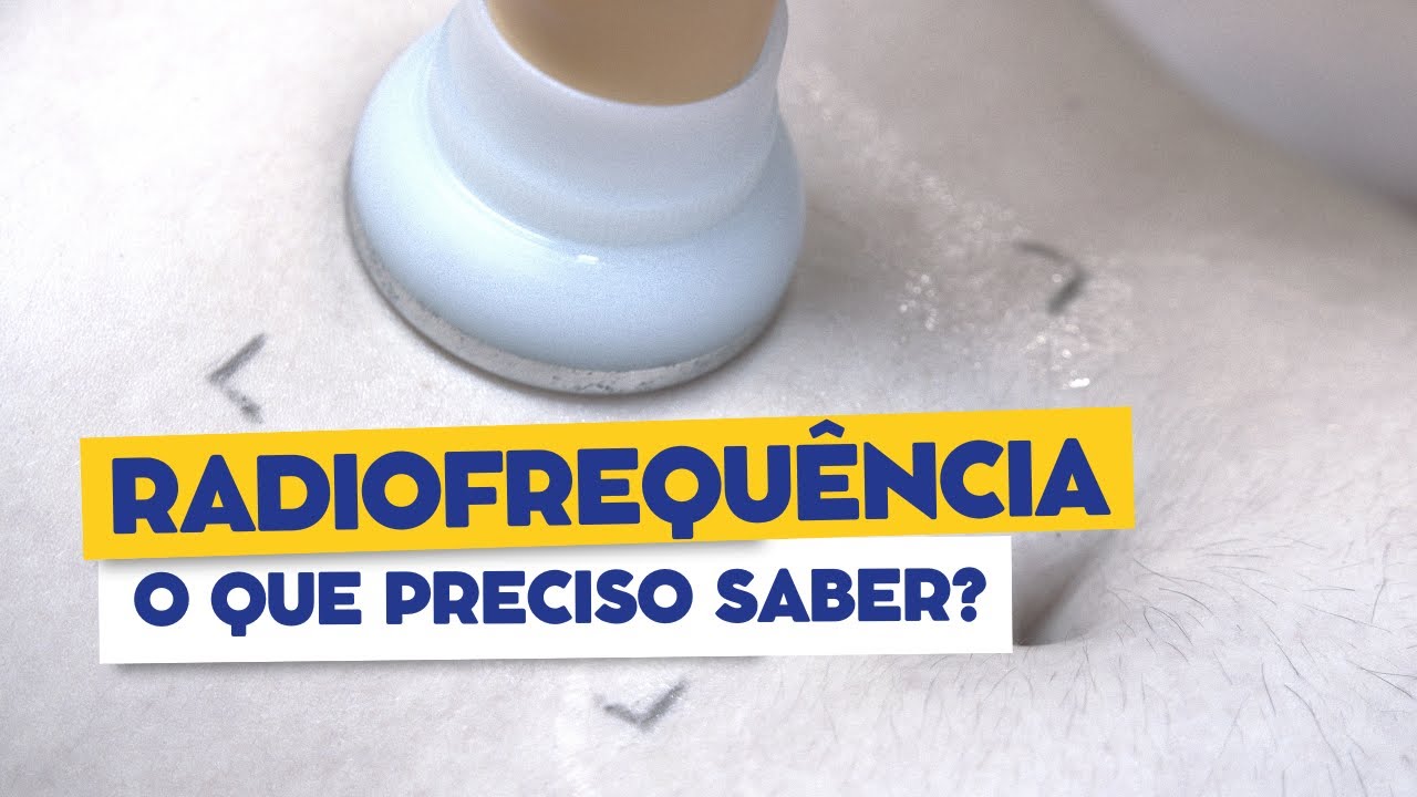 Entendendo os tipos de radiofrequ&ecirc;ncia | Dr. Jo&atilde;o Tassinary