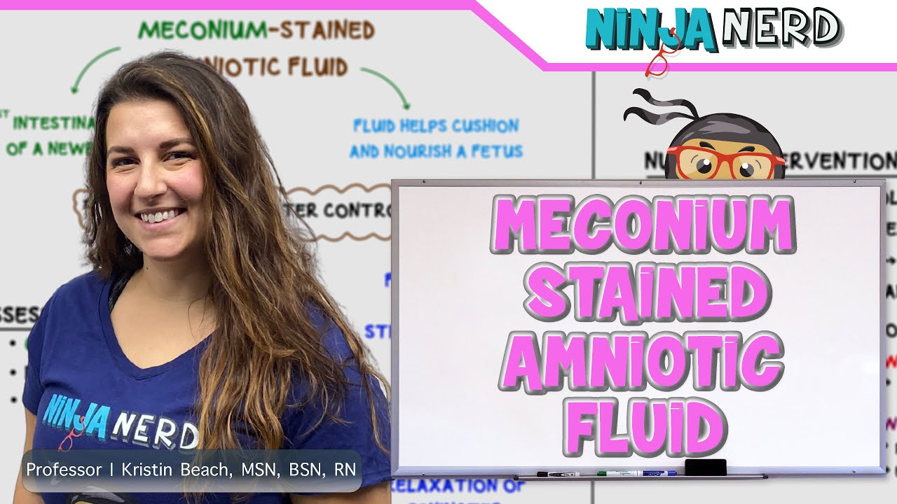 Meconium Stained Amniotic Fluid