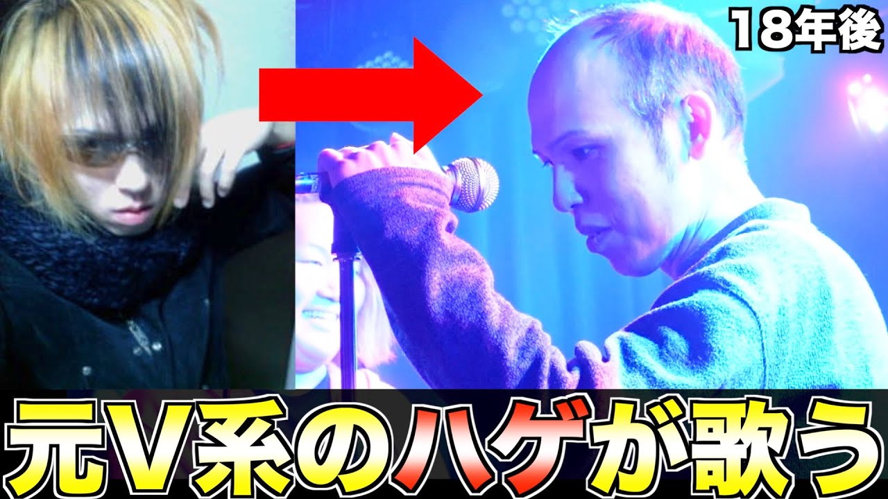 このハゲ知ってますか？【元V系】