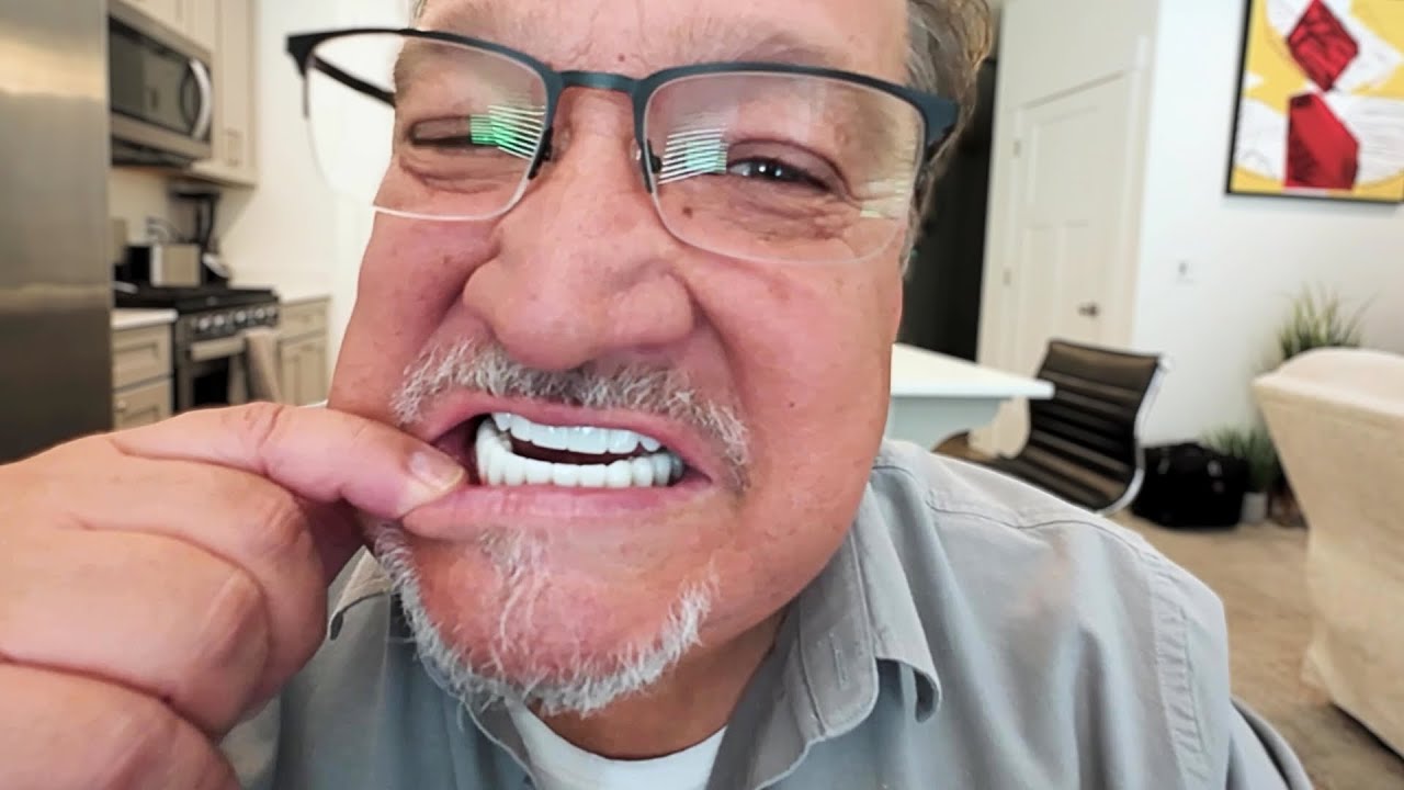 5 Things I WISH I was told BEFORE buying Full Mouth IMPLANTS