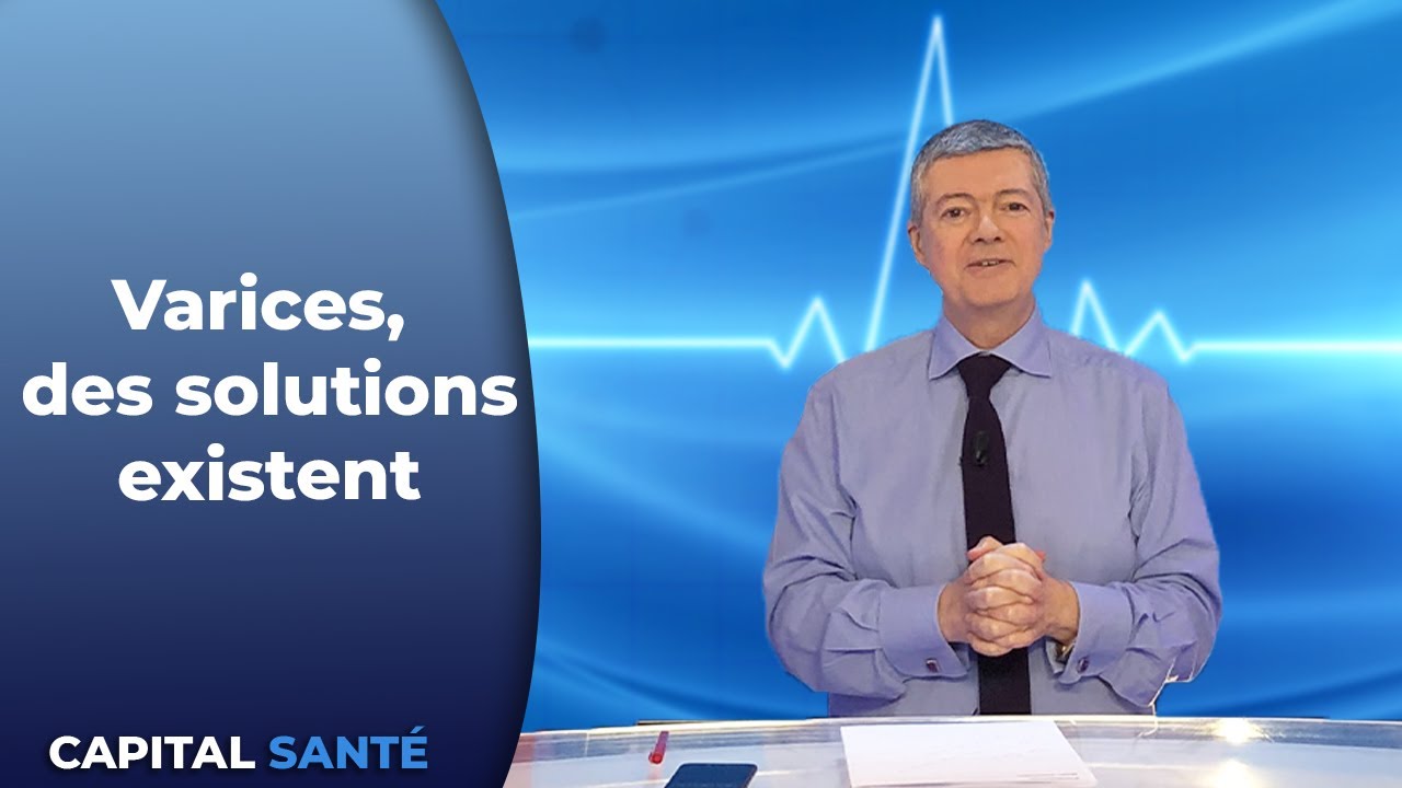 Varices, des solutions existent