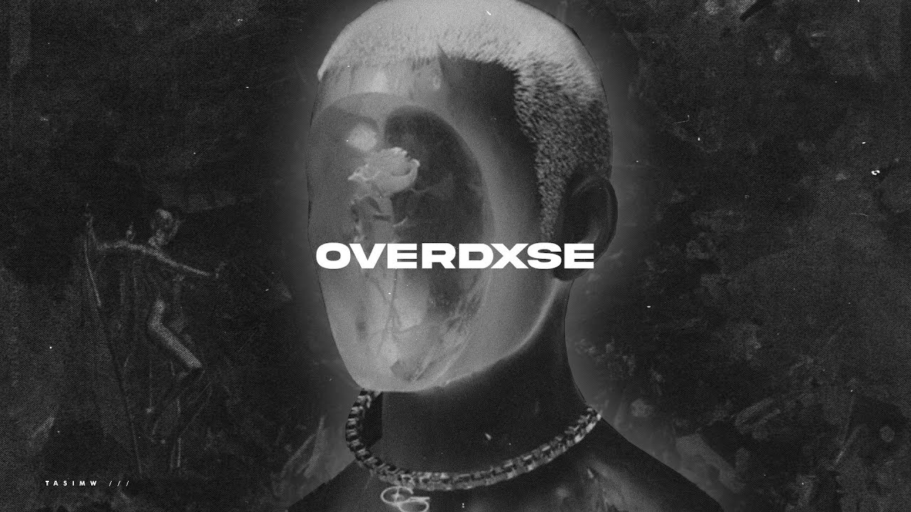 FREE ≡ Chase Atlantic Type Beat - 'OVERDXSE' | Dark Cinematic Type Beat 2022