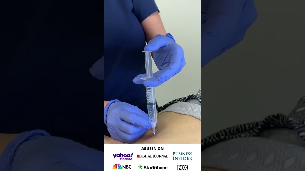 Ozone Treatment to the Spine