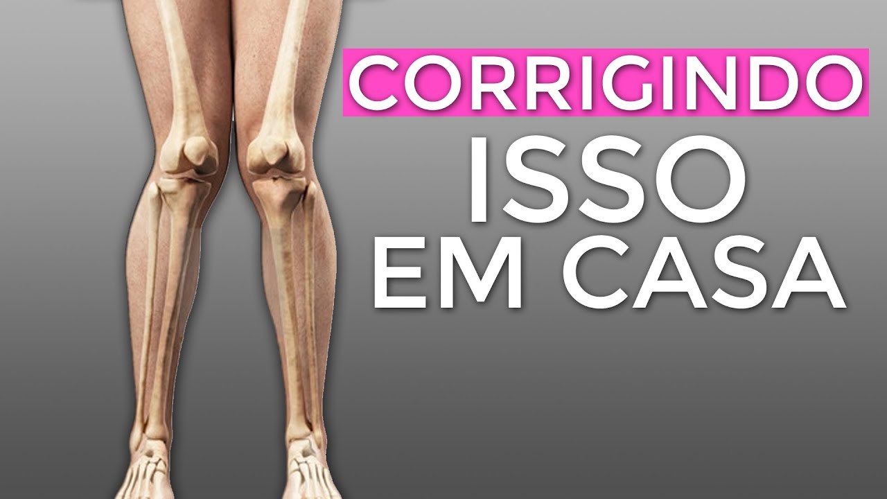 Como corrigir o Joelho VALGO - Joelho para DENTRO (Em CASA 3 Exercícios)