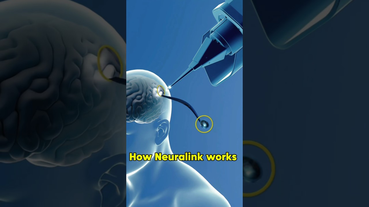 How Neuralink works? #health #technology #shorts