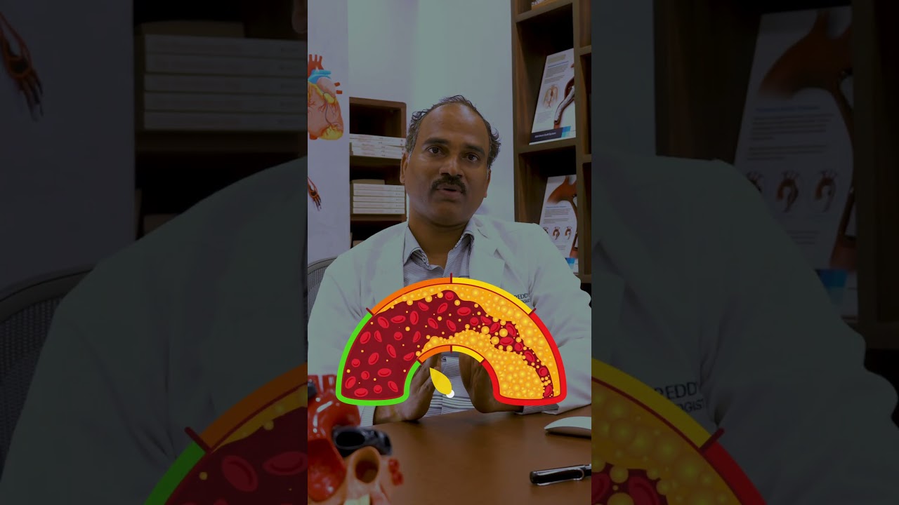 Calcium Score Test: Why It Matters for Your Heart Health | Medicover Hospitals