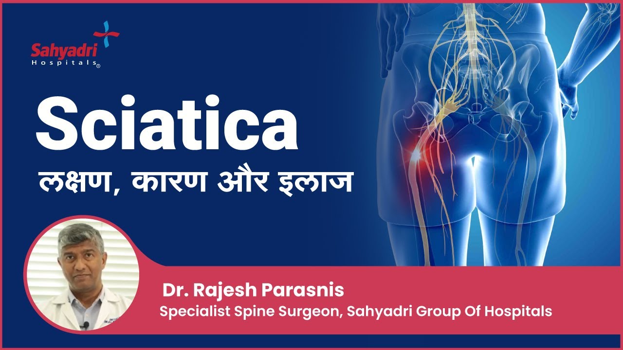 साइटिका के लक्षण, कारण, इलाज | Sciatica in Hindi | Sciatica क्या है? | Dr Rajesh Parasnis , Sahyadri