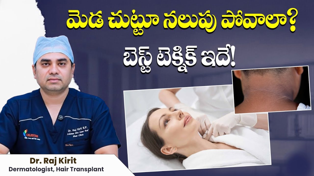 మెడ చుట్టూ నలుపు పోవాలంటే ఏం చేయాలి? | Acanthosis Nigricans Causes & Treatments | Celestee Clinic