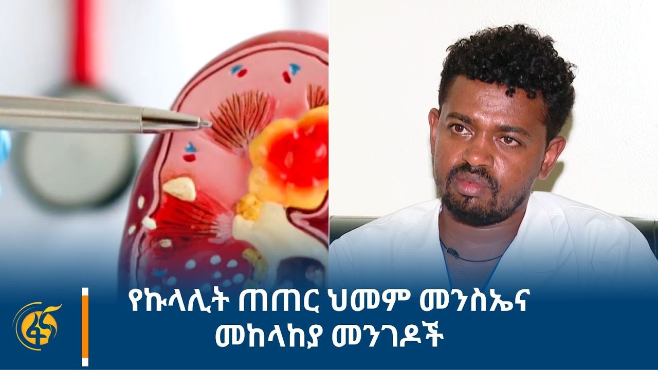 የኩላሊት ጠጠር ህመም መንስኤና መከላከያ መንገዶች