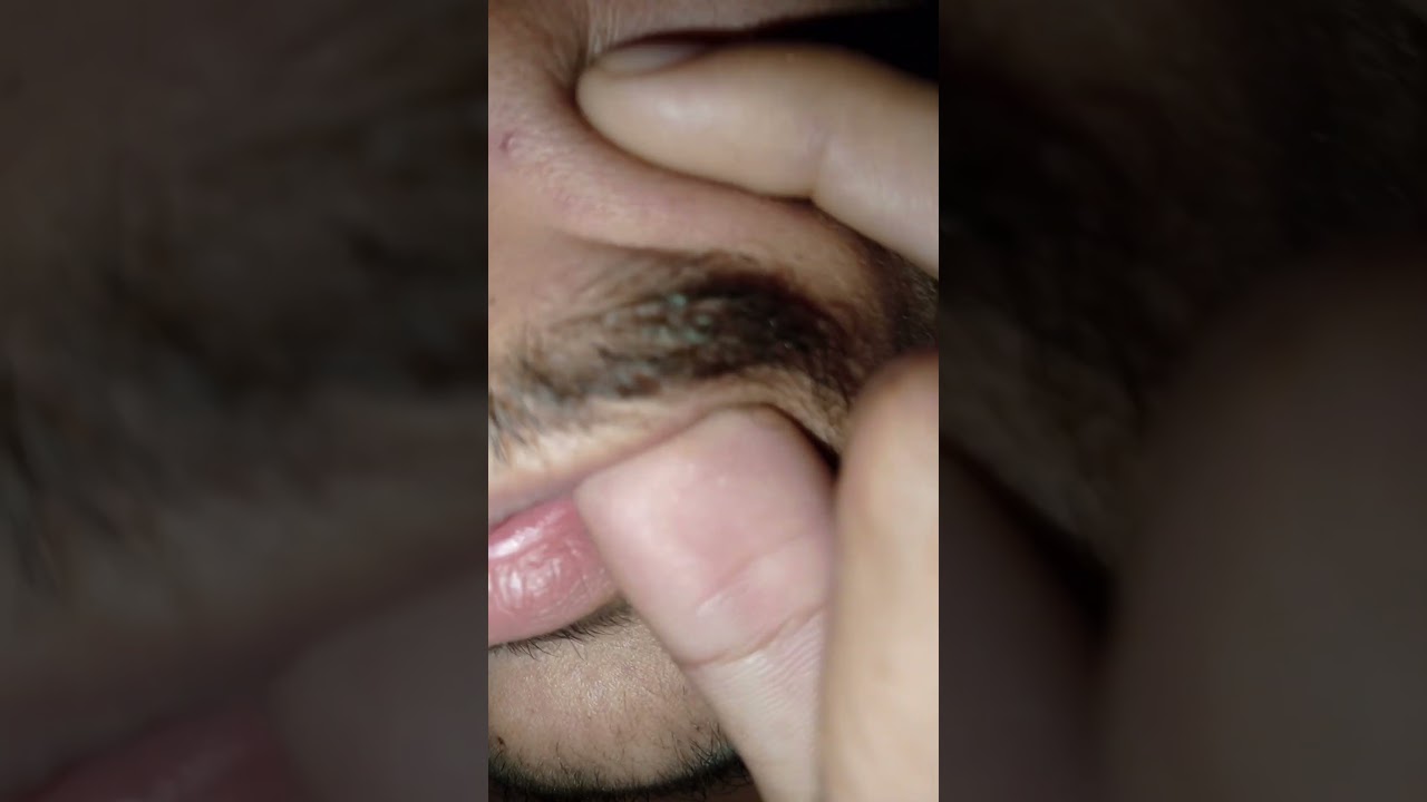 #saloon #beard #satisfying #ingrownhairremovel #lashes #skincare #blackheads #oddlysatisfying #relex
