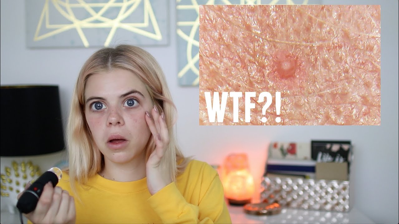 MAKEUP VS NO MAKEUP UNDER A MICROSCOPE 🤢