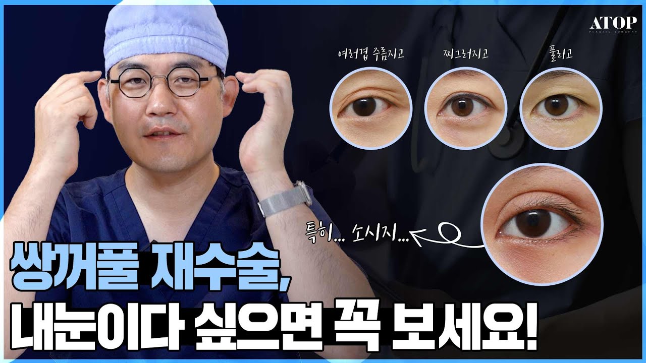 [Dr.이한정] 첫 눈수술이 망쳤다면?💦필수시청!💥 사례별로 확인하는 눈재수술🤞💗